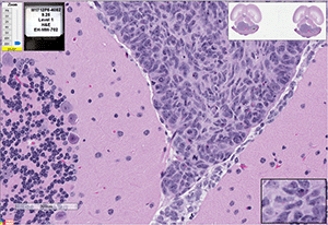 Med-1712FH cells