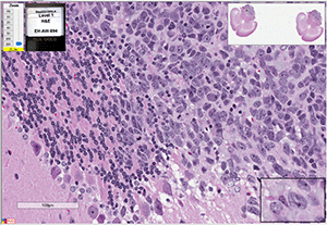 Med-2312FH cells