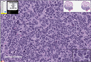 Med-314FH cells