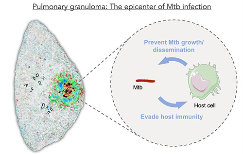 Pulmonary granuloma: The epicenter of Mtb infection